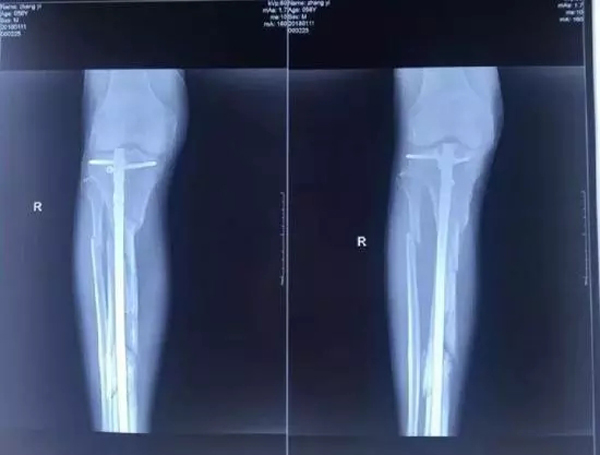 廊坊城南医院院长坠楼:股东屡被举报仍当人大